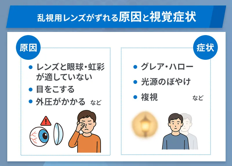 ICLで乱視用レンズがずれる原因や視覚症状について解説