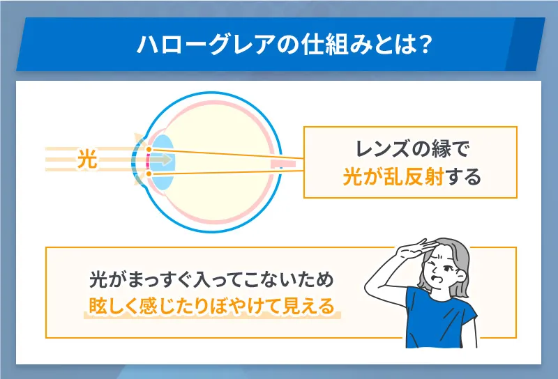 ハローグレアはレンズの縁で光が反射することでまぶしく感じたりぼやけて感じたりする現象