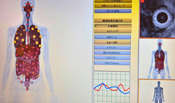 原因不明の不調を可視化